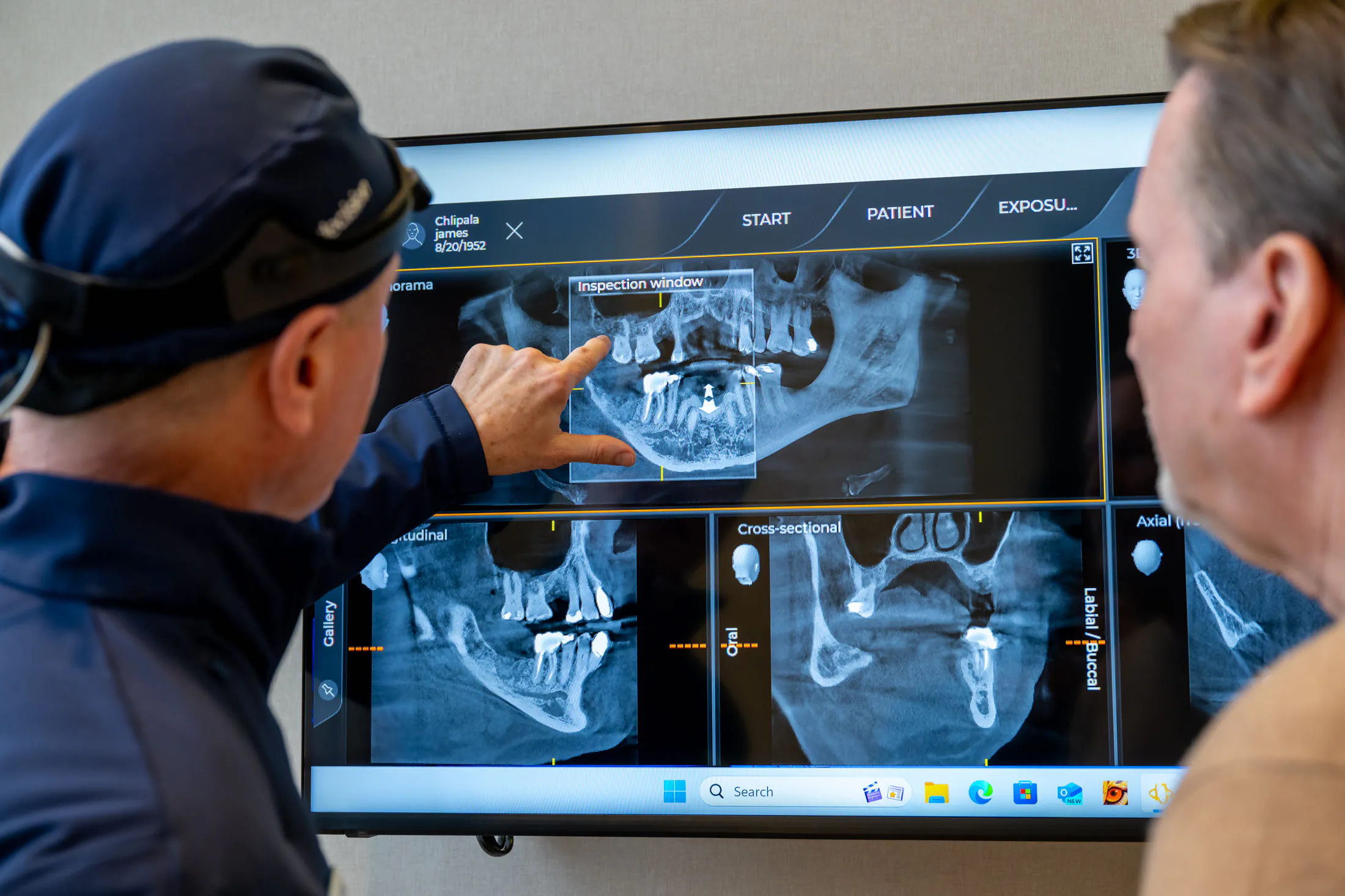 Wise Decision surgical team during a wisdom teeth removal procedure